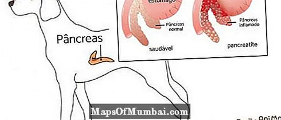 Canal pancreatitis: sabab sareng perlakuan