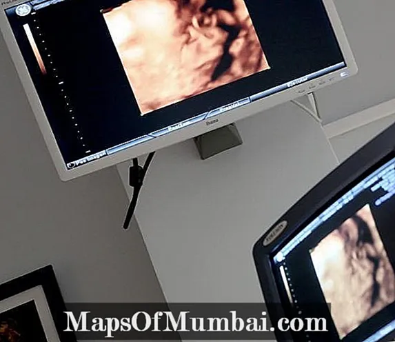 i-ultrasound yezinja